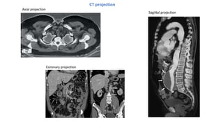 computed tomography | PDF