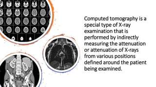 computed tomography | PDF