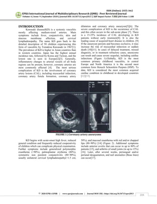ISSN (Online): 2455-3662
EPRA International Journal of Multidisciplinary Research (IJMR) - Peer Reviewed Journal
Volume: 6 | Issue: 9 | September 2020 || Journal DOI: 10.36713/epra2013 || SJIF Impact Factor: 7.032 ||ISI Value: 1.188
2020 EPRA IJMR | www.eprajournals.com | Journal DOI URL: https://doi.org/10.36713/epra2013
204
INTRODUCTION
Kawasaki disease(KD) is a systemic vasculitis
mostly affecting medium-sized arteries. Main
symptoms include fever, conjunctivitis, skin and
mucous membrane affection, and cervical
lymphadenopathy. The name KD goes back to the
detailed description of 50 children experiencing this
form of vasculitis by Tomakisu Kawasaki in 1967[1].
The prevalence of KD is higher in Asian countries than
in western countries. Japan has the highest annual
incidence rate, followed by Korea and Taiwan, and the
lowest rate is seen in Europe[2][3]. Generally,
inflammatory changes to arterial vessels of all body
regions can be present, however, coronary arteries are
most commonly affected [4]. The most serious
complication of KD is the involvement of coronary
artery lesions (CAL), including myocardial infarction,
coronary artery fistula formation, coronary artery
dilatation and coronary artery aneurysm[5][6]. The
severe complication of KD is the occurrence of CAL
and this often occurs in the sub-acute phase [7]. There
is a 15-25% incidence of CAL developing in KD
patients without early treatment[8]. It is also the
leading cause of acquired heart disease in children. [9]
If the aneurysm persists and becomes occlusive, it may
increase the risk of myocardial infarction or sudden
death [10][11]. In cases of delayed treatment, missed
diagnosis, or in treatment refractory cases, aneurysms
can result and cause severe sequelae, including cardiac
infarctions (Figure 1).Globally, KD is the most
common primary childhood vasculitis, in central
Europe and North America it is the second most
common form Henoch Schoenlein Purpura (HSP). To
date, KD is considered the most common acquired
cardiac condition in childhood in developed countries
[12][13].
FIGURE 1 | Coronary artery aneurysms
KD begins with acute-onset high fever, reduced
general condition and frequently reduced cooperativity
of children which can complicate physical examination.
Further symptoms include generalized polymorphic
exanthema (>90%), palmoplantar erythema (80%),
symmetric non purulent conjunctivitis (80–90%),
usually unilateral cervical lymphadenopathy(>1.5 cm;
50%), and mucosal enanthema with red and/or chapped
lips (80–90%) [14] (Figure 2). Additional symptoms
include anterior uveitis that can occur in up to 80% of
patients [15], and arthritis of small joints (in up to 15%)
[16]. Later, after several weeks, periungual and/or
perianal desquamation, and nail anomalies (Beau lines)
can occur[17].
 
