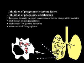 Proposed Macrophage Survival Mechanisms of M. tuberculosis
• Inhibition of phagosome-lysosome fusion
• Inhibition of phagosome acidification
• Resistance to reactive oxygen intermediates/reactive nitrogen intermediates
• Inhibition of antigen presentation
• Inhibition of IFN-gamma activation
• Interaction with the cytoplasm
 