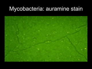 Mycobacteria: auramine stain
 