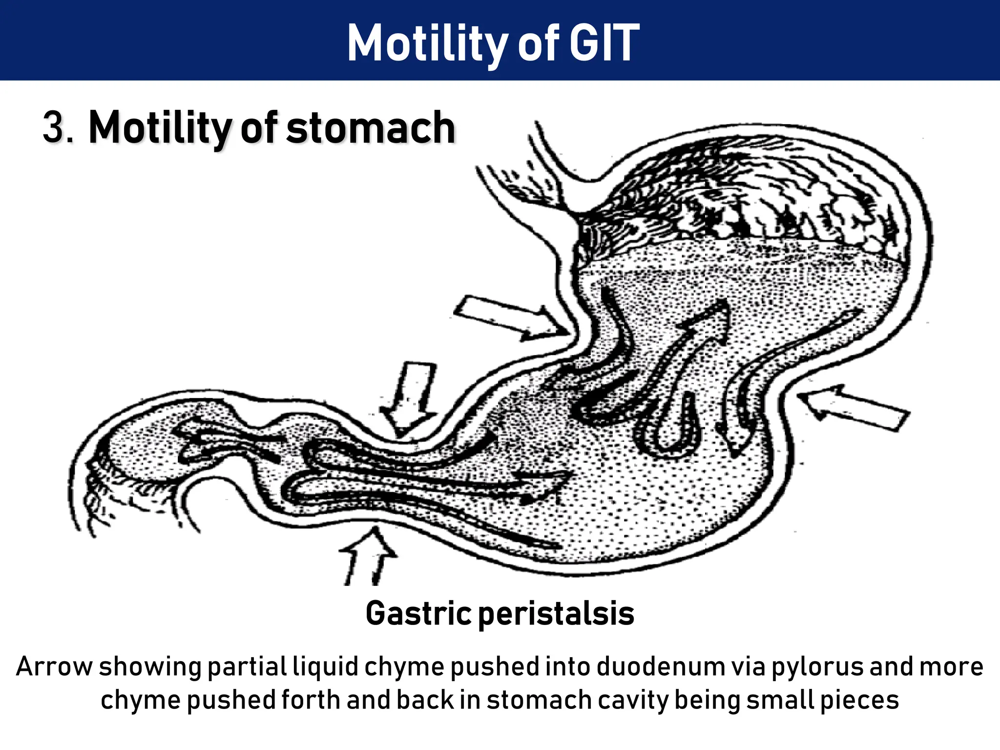 3. Motility of stomach
Gastric peristalsis
Arrow showing partial liquid chyme pushed into duodenum via pylorus and more
chyme pushedforth and back in stomach cavity being small pieces
Motility of GIT
 