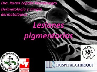 Lesiones
pigmentarias
Dra. Karen Zapata Montenegro
Dermatología y cirugía
dermatológica
 