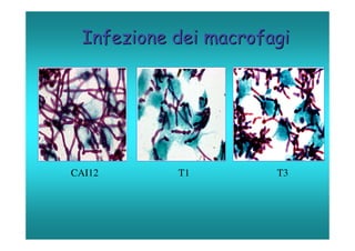 Infezione dei macrofagi




CAI12      T1         T3
 