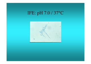 IFE: pH 7.0 / 37°C
 