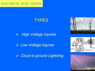 Electric burn injury Conference Presentation | PDF