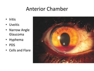 20 eye diseases ppt Diseae ses Of The Eye PPTX 20-eye-diseases-ppt-diseae-ses-of-the-eye-pptx