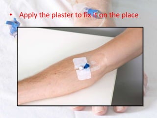 20 iv cannulation | PPTX