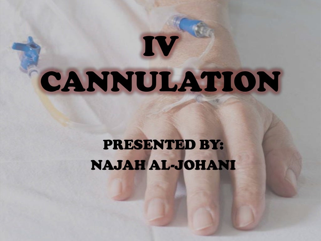 20 iv cannulation
