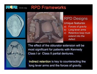 20. (new)restoration of soft palate defects | PDF