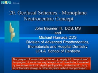 20. Occlusal Schemes - Monoplane  Neutrocentric Concept John Beumer III,  DDS, MS and Michael Hamada DDS Division of Advanced Prosthodontics, Biomaterials and Hospital Dentistry UCLA  School of Dentistry This program of instruction is protected by copyright ©.  No portion of this program of instruction may be reproduced, recorded or transferred by any means electronic, digital, photographic, mechanical etc., or by any information storage or retrieval system, without prior permission. 