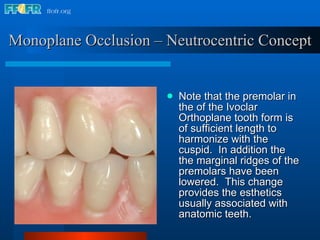 Sufficient Ridges 20.occlusal schemes monoplane-neutrocentric concept | PPT
