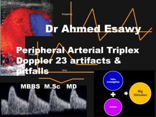 20 peripheral arterial triplex ultrasound  artifact pitfalls dr ahmed esawy