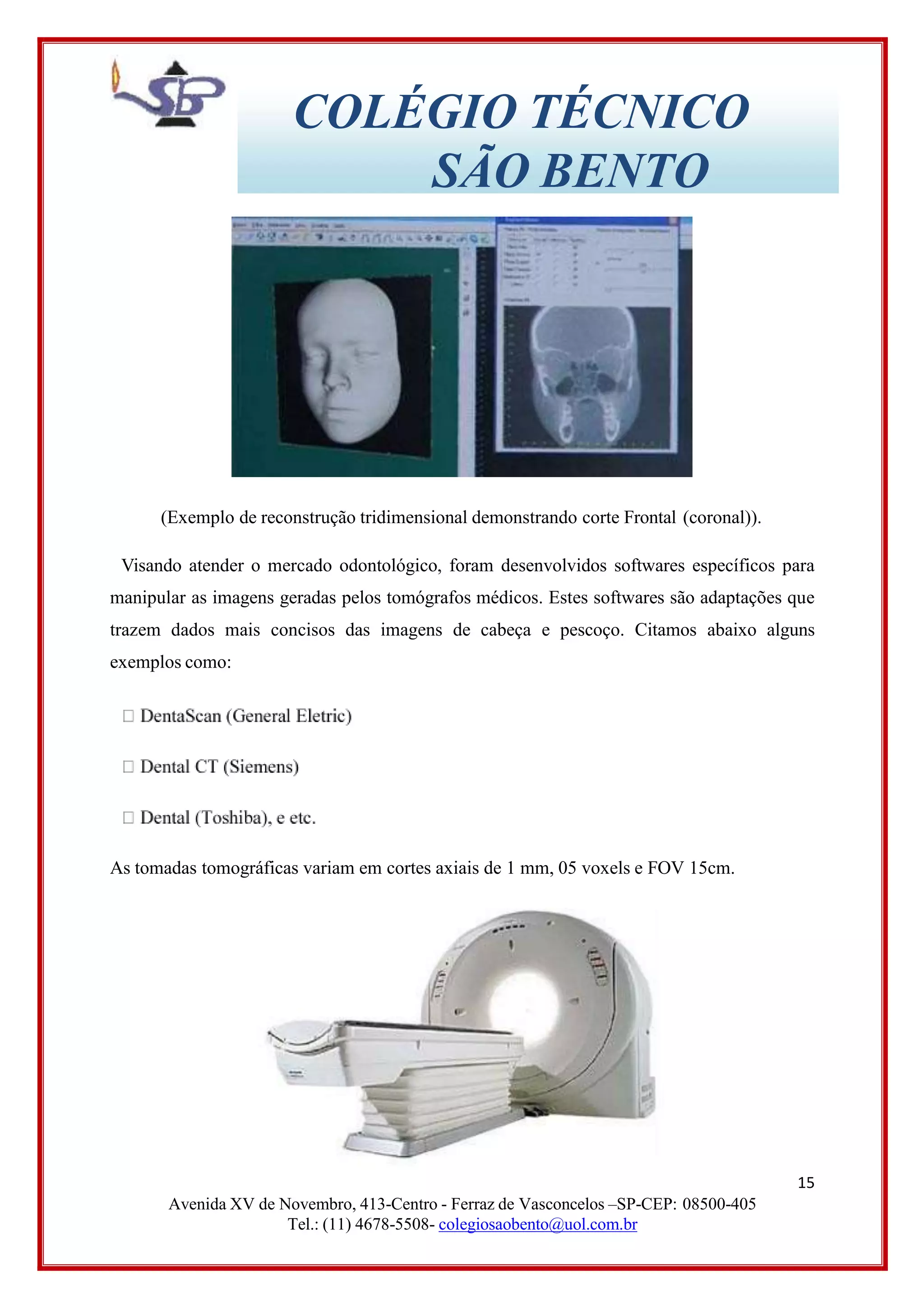 COLÉGIO TÉCNICO
SÃO BENTO
(Exemplo de reconstrução tridimensional demonstrando corte Frontal (coronal)).
Visando atender o mercado odontológico, foram desenvolvidos softwares específicos para
manipular as imagens geradas pelos tomógrafos médicos. Estes softwares são adaptações que
trazem dados mais concisos das imagens de cabeça e pescoço. Citamos abaixo alguns
exemplos como:
As tomadas tomográficas variam em cortes axiais de 1 mm, 05 voxels e FOV 15cm.
15
Avenida XV de Novembro, 413-Centro - Ferraz de Vasconcelos –SP-CEP: 08500-405
Tel.: (11) 4678-5508- colegiosaobento@uol.com.br
 