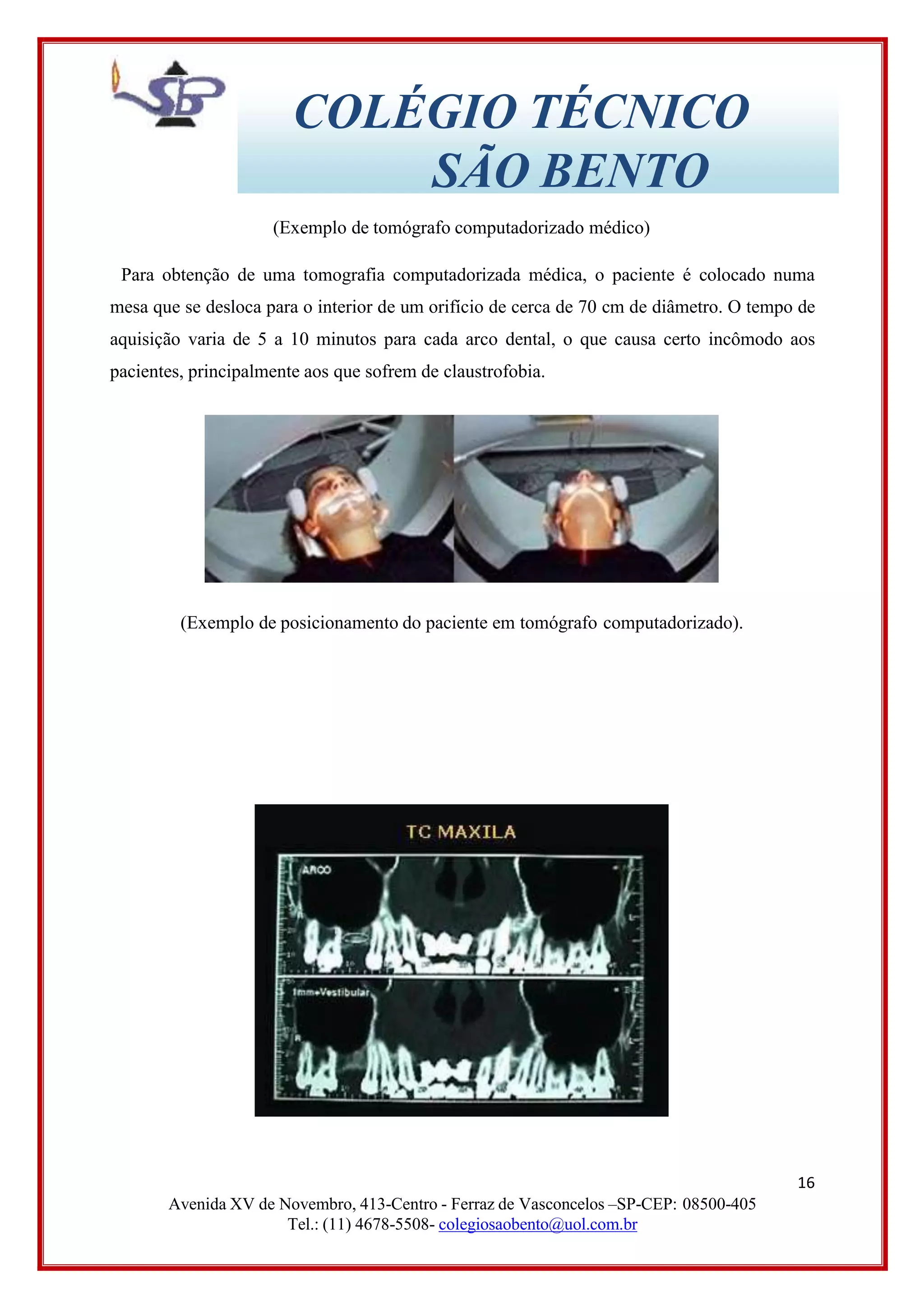 COLÉGIO TÉCNICO
SÃO BENTO
(Exemplo de tomógrafo computadorizado médico)
Para obtenção de uma tomografia computadorizada médica, o paciente é colocado numa
mesa que se desloca para o interior de um orifício de cerca de 70 cm de diâmetro. O tempo de
aquisição varia de 5 a 10 minutos para cada arco dental, o que causa certo incômodo aos
pacientes, principalmente aos que sofrem de claustrofobia.
(Exemplo de posicionamento do paciente em tomógrafo computadorizado).
16
Avenida XV de Novembro, 413-Centro - Ferraz de Vasconcelos –SP-CEP: 08500-405
Tel.: (11) 4678-5508- colegiosaobento@uol.com.br
 