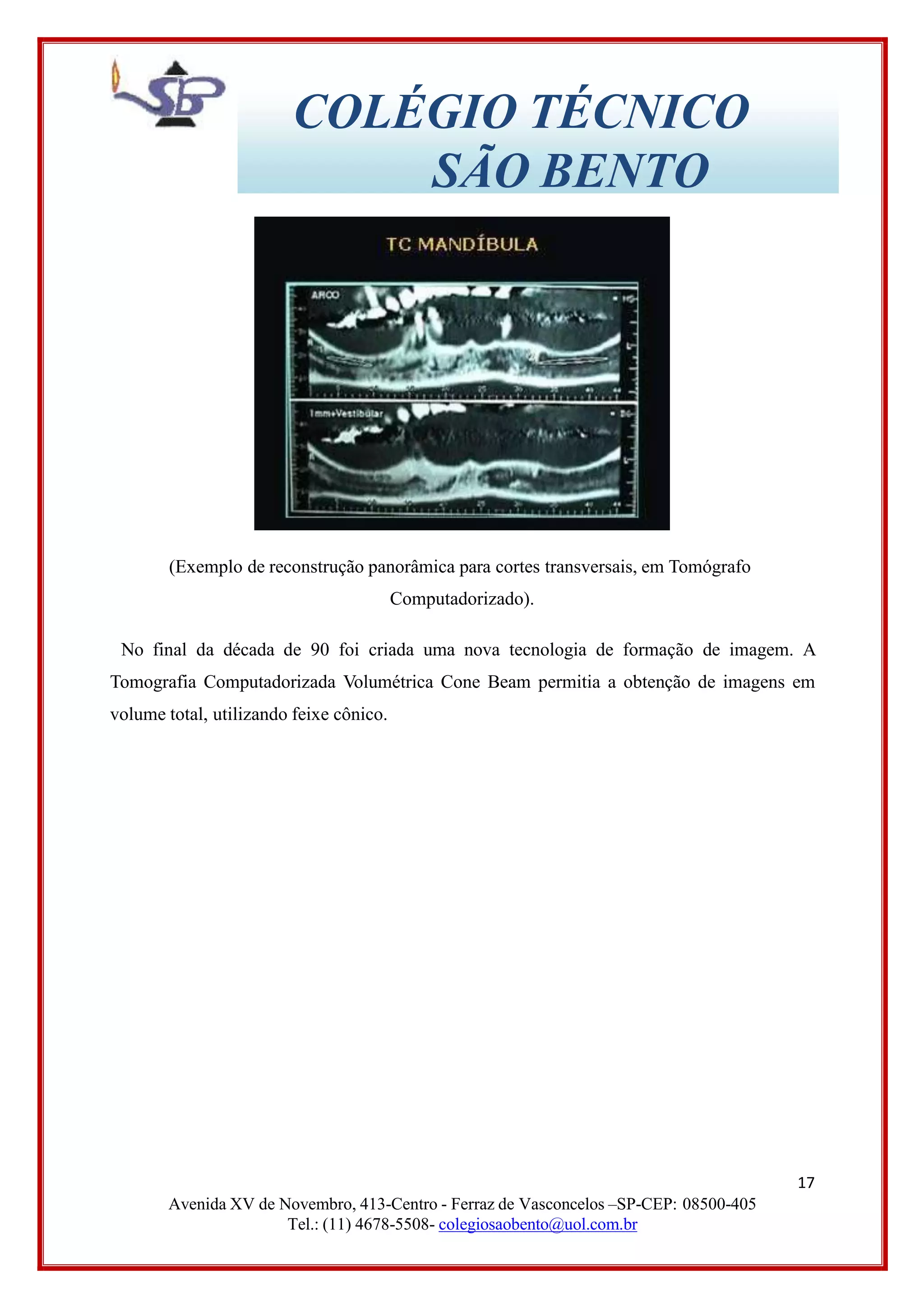 COLÉGIO TÉCNICO
SÃO BENTO
(Exemplo de reconstrução panorâmica para cortes transversais, em Tomógrafo
Computadorizado).
No final da década de 90 foi criada uma nova tecnologia de formação de imagem. A
Tomografia Computadorizada Volumétrica Cone Beam permitia a obtenção de imagens em
volume total, utilizando feixe cônico.
17
Avenida XV de Novembro, 413-Centro - Ferraz de Vasconcelos –SP-CEP: 08500-405
Tel.: (11) 4678-5508- colegiosaobento@uol.com.br
 