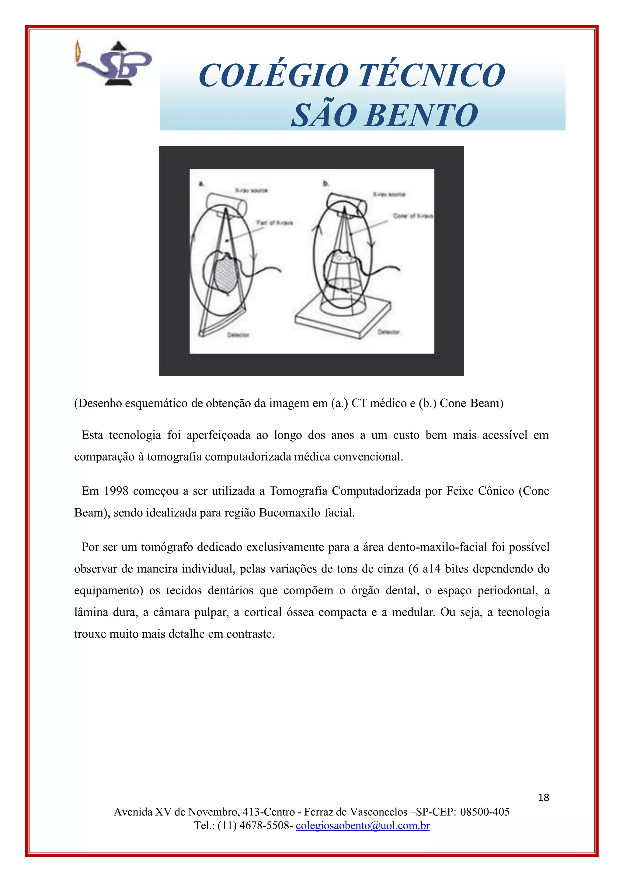 COLÉGIO TÉCNICO
SÃO BENTO
(Desenho esquemático de obtenção da imagem em (a.) CT médico e (b.) Cone Beam)
Esta tecnologia foi aperfeiçoada ao longo dos anos a um custo bem mais acessível em
comparação à tomografia computadorizada médica convencional.
Em 1998 começou a ser utilizada a Tomografia Computadorizada por Feixe Cônico (Cone
Beam), sendo idealizada para região Bucomaxilo facial.
Por ser um tomógrafo dedicado exclusivamente para a área dento-maxilo-facial foi possível
observar de maneira individual, pelas variações de tons de cinza (6 a14 bites dependendo do
equipamento) os tecidos dentários que compõem o órgão dental, o espaço periodontal, a
lâmina dura, a câmara pulpar, a cortical óssea compacta e a medular. Ou seja, a tecnologia
trouxe muito mais detalhe em contraste.
18
Avenida XV de Novembro, 413-Centro - Ferraz de Vasconcelos –SP-CEP: 08500-405
Tel.: (11) 4678-5508- colegiosaobento@uol.com.br
 