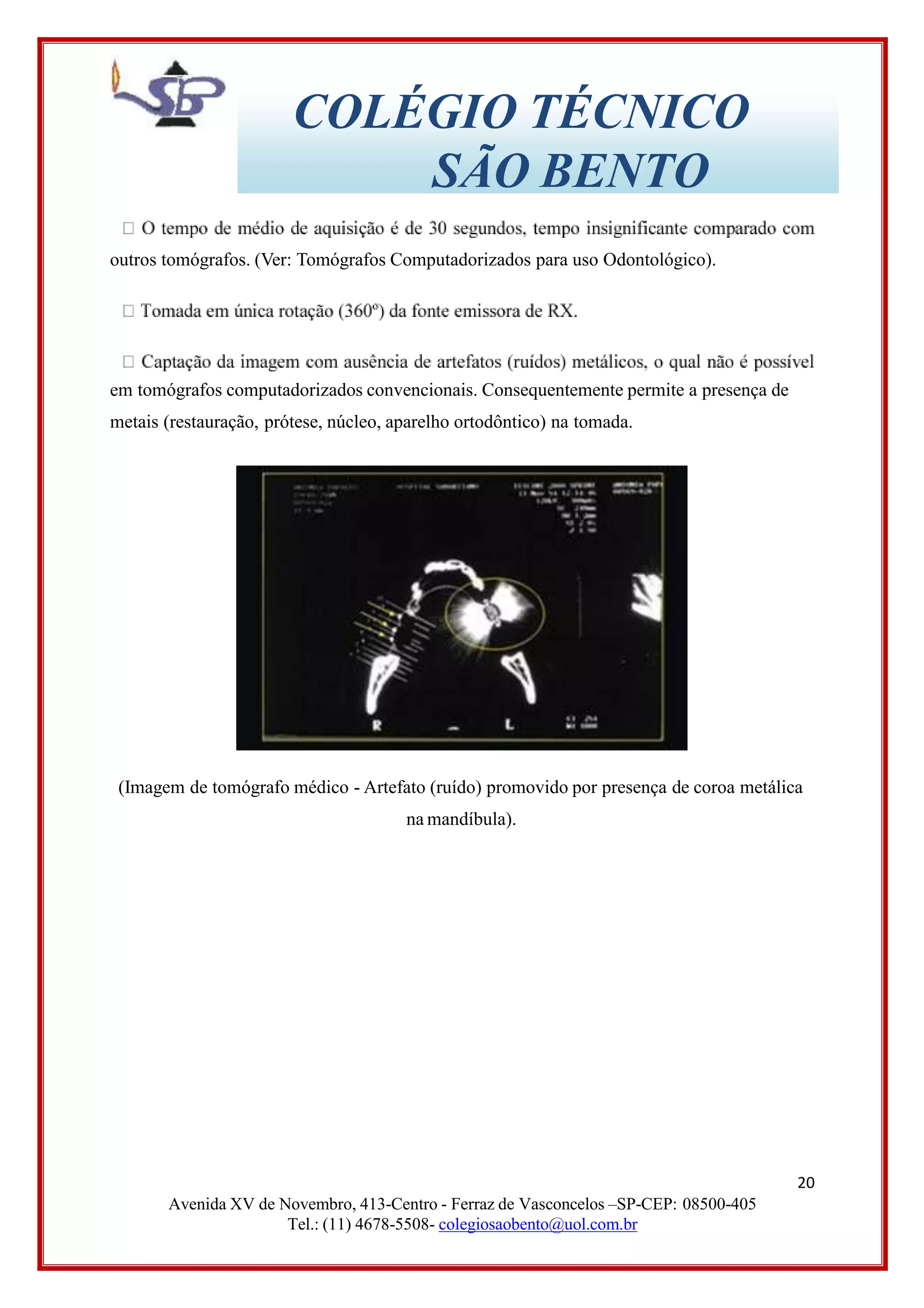 COLÉGIO TÉCNICO
SÃO BENTO
outros tomógrafos. (Ver: Tomógrafos Computadorizados para uso Odontológico).
em tomógrafos computadorizados convencionais. Consequentemente permite a presença de
metais (restauração, prótese, núcleo, aparelho ortodôntico) na tomada.
(Imagem de tomógrafo médico - Artefato (ruído) promovido por presença de coroa metálica
na mandíbula).
20
Avenida XV de Novembro, 413-Centro - Ferraz de Vasconcelos –SP-CEP: 08500-405
Tel.: (11) 4678-5508- colegiosaobento@uol.com.br
 