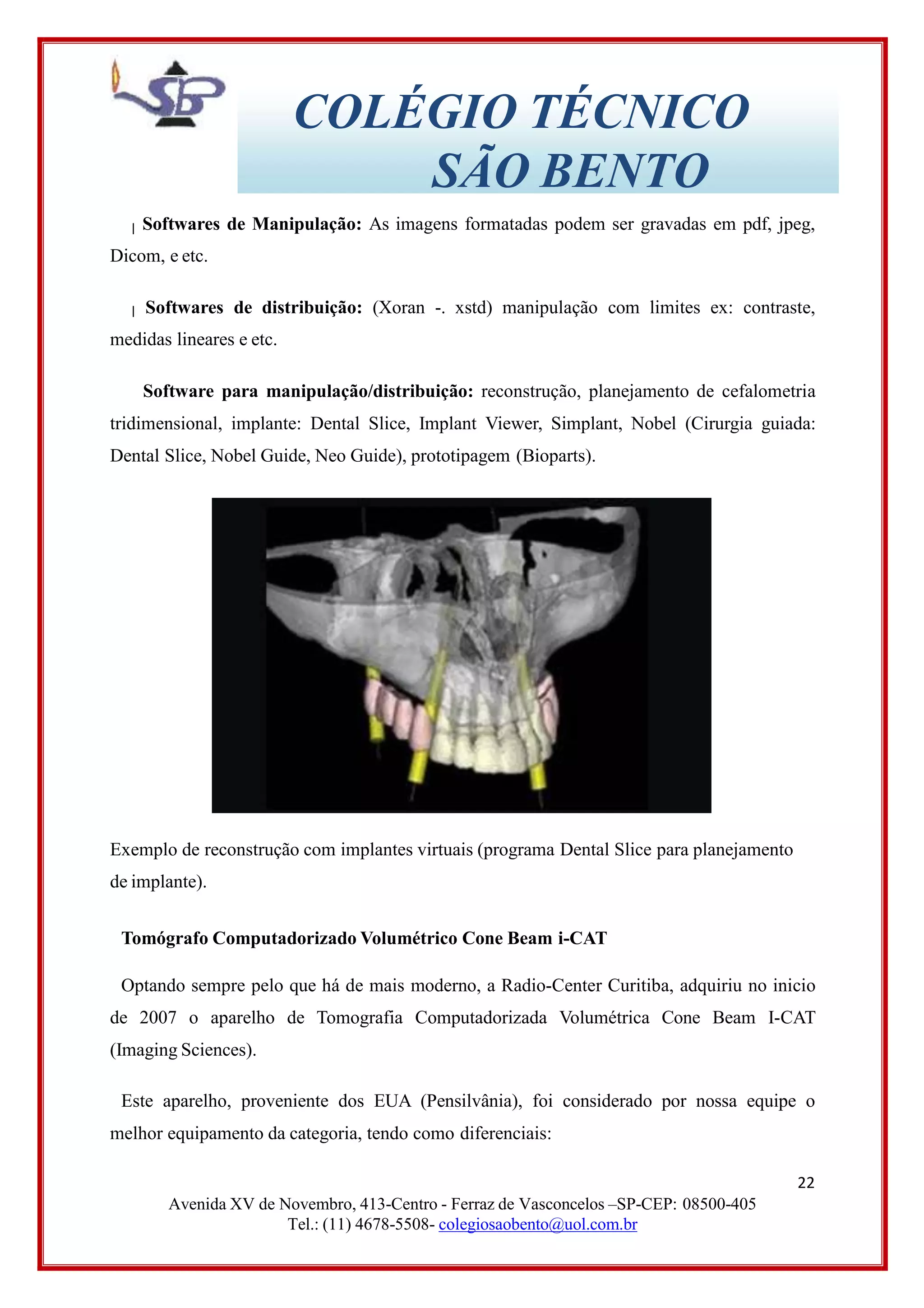 COLÉGIO TÉCNICO
SÃO BENTO
Softwares de Manipulação: As imagens formatadas podem ser gravadas em pdf, jpeg,
Dicom, e etc.
Softwares de distribuição: (Xoran -. xstd) manipulação com limites ex: contraste,
medidas lineares e etc.
Software para manipulação/distribuição: reconstrução, planejamento de cefalometria
tridimensional, implante: Dental Slice, Implant Viewer, Simplant, Nobel (Cirurgia guiada:
Dental Slice, Nobel Guide, Neo Guide), prototipagem (Bioparts).
Exemplo de reconstrução com implantes virtuais (programa Dental Slice para planejamento
de implante).
Tomógrafo Computadorizado Volumétrico Cone Beam i-CAT
Optando sempre pelo que há de mais moderno, a Radio-Center Curitiba, adquiriu no inicio
de 2007 o aparelho de Tomografia Computadorizada Volumétrica Cone Beam I-CAT
(Imaging Sciences).
Este aparelho, proveniente dos EUA (Pensilvânia), foi considerado por nossa equipe o
melhor equipamento da categoria, tendo como diferenciais:
22
Avenida XV de Novembro, 413-Centro - Ferraz de Vasconcelos –SP-CEP: 08500-405
Tel.: (11) 4678-5508- colegiosaobento@uol.com.br
 
