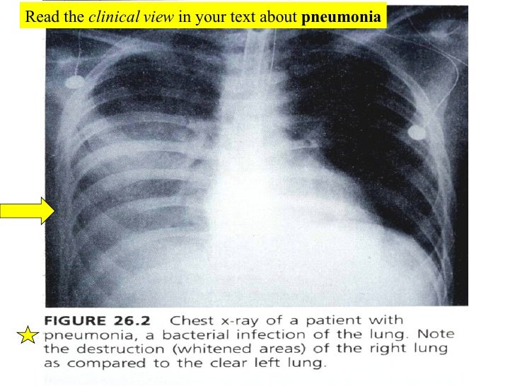 20 Respiratory System