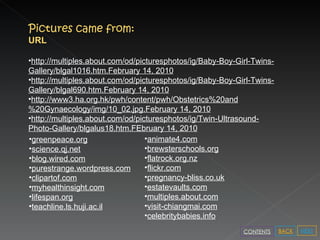 Pictures came from: URL http://multiples.about.com/od/picturesphotos/ig/Baby-Boy-Girl-Twins-Gallery/blgal1016.htm .February 14, 2010 http://multiples.about.com/od/picturesphotos/ig/Baby-Boy-Girl-Twins-Gallery/blgal690.htm .February 14, 2010 http://www3.ha.org.hk/pwh/content/pwh/Obstetrics%20and%20Gynaecology/img/10_02.jpg.February 14, 2010 http://multiples.about.com/od/picturesphotos/ig/Twin-Ultrasound-Photo-Gallery/blgalus18.htm.FEbruary 14, 2010 greenpeace.org science.qj.net blog.wired.com purestrange.wordpress.com clipartof.com myhealthinsight.com lifespan.org teachline.ls.huji.ac.il animate4.com brewsterschools.org flatrock.org.nz flickr.com pregnancy-bliss.co.uk estatevaults.com multiples.about.com visit-chiangmai.com celebritybabies.info NEXT BACK CONTENTS 