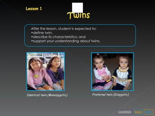 Fraternal twin (Dizygotic) Identical twin (Monozygotic) After the lesson, student is expected to: define twin; describe its characteristics; and support your understanding about twins. NEXT BACK CONTENTS 