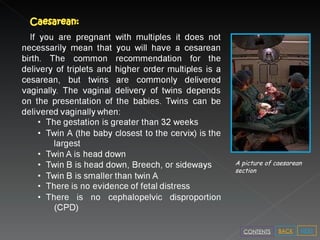 A picture of caesarean section NEXT BACK CONTENTS 
