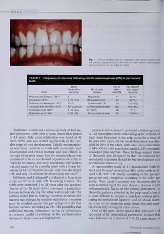 • Amir et ai 
Fig 1 Ciinicai photograph oí a maxiiiary ielt centrai incisor with 
the ciassic appearance of CM; note the dark yeilow discoloration 
when compared to the adjacent teeth 
TABLE 1 Frequency of necrosis following calcific metamorphosis (CM) in permanent 
teeth 
Study 
Holcomb and Gregory 1967" 
Andreasen 1970' 
Stâihane and Hedegard 1975^ 
Jacobsen and Kerekes 1977™ 
Andreasen et ai 1987" 
Rcbertson et al 1996'' 
Mean 
observation 
period (y) 
4 
1-12(3,4) 
13-21 
10-23(16.0) 
1-10(3.6) 
7-22(16) 
No, of units 
studied 
88 patients 
189 iuxated teeth 
76 teeth with CM 
122 traumatized teeth 
637 teeth 
82 traumatized teeth 
No. of 
teeth 
with CM 
4t 
42 
76 
122 
96 
82 
No. of teeth 
with puipai 
necrosis 
3 (7%) 
3 (7%) 
12(16%) 
16(13%) 
1 (1%) 
7 (8.5%) 
Andreasen' conducted a follow-up study of 189 litx-ated 
permanent teeth with a mean observation period 
of 3,4 years. Pulp canal obliteration was found in 42 
teeth (22'*/o) and was reiated significantly to the vari-able 
stage of root development. Calcific metamorpho-sis 
was more common iti teeth with incomplete root 
development and crown fracture and was related to 
the type of luxation injury, Calcific metatnorphosis was 
considered to be an accelerated deposition of dentin in 
response to trauma, and early endodontic intervention 
was not supported. In a similar study with a 5-year fol-low- 
up of 637 permanent incisors, only lS'i/o developed 
CM, and only lVo of those developed pulp necrosis,'' 
Stálhane and Hedegard' conducted a long-term 
study on 76 teeth with CM following trauma. The 
teeth were examined 3 to 21 years after the accident. 
Twelve of the 76 teetb (16%) developed a periradicu-lar 
rarefaction during the observation period. The 
authors stated that in making treatment decisions, the 
success rate enjoyed by modern endodontic treatment 
must be weighed against the percentage of teeth that 
become necrotie secondary to CM. The possibility that 
additional trauma, subsequent earies, or orthodontic 
movement could contribute to the periradicular 
changes in these cases was highlighted. 
Jacobsen and Kerekes^" conducted a follow-up study 
of 122 traumatized teeth with radiographie evidence of 
hard tissue formation in the pulp cavity for a mean of 
16 years after injury. Partial canal obliteration was iden-tified 
in 36% of the cases, with total canal obliteration 
in 64%. Of the total population studied, 13% eventually 
developed pulp necrosis. These findings support those 
of Holcomb and Gregory'-* in that the rationale for 
endodontie treatment should be the development of a 
periradieular radiolucency. 
A retrospective study of 517 traumatized teeth by 
Roek and Grundy'' showed that 16% of the teeth devel-oped 
CM, with CM mostly occurring in the younger 
age group and résorption occurring in the older age 
group. Root canal treatment was recomtnended as 
soon as narrowing of the pulp chatnber shadow is seen 
radiographicaiiy, based on two clinical parameters: (Ij 
Once the guidance afforded by the pulp canal is lost, it 
is more difficult to prepare a post hole without pene-trating 
the periodontal ligament; and (2) should necro-sis 
occur in the retnaining apical tissue, the only possi-ble 
access may be surgical intervention. 
One of the most recent studies that addressed CM 
consisted of 82 traumatized permanent incisors that 
were followed for a period of 7 to 22 years (mean 16 
448 Voiume 32, Number B, 2D01 
 