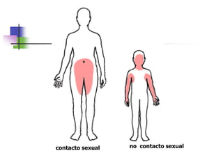 contacto sexual no contacto sexual
 