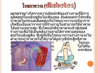 เบาหวาน เกิดจากความผิดปกติของร่างกายที่มีการ
ผลิตฮอร์โมนอินซูลินไม่เพียงพอ อันส่งผลทำาให้ระดับ
นำำาตาลในกระแสเลือดสูงเกินโรคเบาหวานจะมีอาการ
เกิดขึนเนื่องมาจากการที่ร่างกายไม่สามารถใช้นำาตาล
       ำ
ได้อย่างเหมาะสม ซึงโดยปกตินำาตาลจะเข้าสู่เซลล์
                     ่
ร่างกายเพื่อใช้เป็นพลังงานภายใต้การควบคุมของ
ฮอร์โมนอินซูลิน ซึ่งผู้ที่เป็นโรคเบาหวานร่างกายจะไม่
สามารถนำานำำาตาลไปใช้งานได้อย่างมีประสิทธิภาพ
ผลที่เกิดขึำนทำาให้ระดับนำำาตาลในเลือดสูงขึำน ในระยะ
ยาวจะมีผลในการทำาลายหลอดเลือด ถ้าหากไม่ได้รับ
การรักษาอย่างเหมาะสม อาจนำาไปสู่สภาวะแทรกซ้อน
ที่รุนแรงได้
 