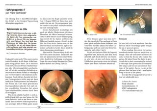 DeArGe Mitteilungen 8(4), 2003                                                                                                                                                      DeArGe Mitteilungen 8(4), 2003




»Ohrgespinst«?
von Frank Schneider

Am Dienstag dem 11 Juni 2002 war folgen-              er, dass er mir eine Kopie zusenden werde.
der Artikel in der hiesigen Tageszeitung              Am 15 August 2002 traf diese dann auch
»Rheinpfalz« abgedruckt:                              endlich bei mir ein. Die entnommene Spin-
                                                      ne konnte er mir jedoch nicht übersenden,
                                                      da er sie »entsorgt« hatte.
                                                          In der Zwischenzeit beschäftigte ich
                                                      mich mit allerlei Gliedertieren, die einen
                                                      Menschen als »Wirt« benutzen könnten.           Abb. 3: Spinne im Ohr.                               Abb. 5: Entnommene Spinne.
                                                      Alles in allem kam ich zu der Überzeugung,
                                                      dass es sich bei der Spinne wohl um eine           Viele Minuten später kam dann im Vi-             SUMMARY:
                                                      Milbenart handeln müsste, die sich in das      deo die eigentliche Überraschung in Form
                                                      Ohr der Frau verirrt haben muss, da das        einer Spinne und eben keiner Milbenart zum           In June 2002 at a local newsletter there has
                                                      Ohrenschmalz normalerweise jegliche In-        Vorschein! Sie füllte nahezu den halben Ge-          been an article concerning a spider living in
                                                      sekten und anderes Getier davon abhält in      hörgang aus und war somit eine kleine Sen-           the ear of person in greece.
                                                      dieses Sinnesorgan einzudringen.               sation für mich (Abb. 3 bis 5).                           When reading this article the author
 Abb. 1: Artikel aus der »Rheinpfalz«.
                                                          Aber welche Überraschung, als ich mir          Als ich mir mehrere Male die Sequenz             wondered whether this was maybe true or
                                                      das Video dann anschaute. Tatsächlich war      angesehen hatte, dachte ich, dass diese Story        simply a fairy tale and started a research in
                                                      dort ein Spinnennetz in Form einer Wohn-       sicherlich auch für die DeArGe von Interes-          order to find the doctor who treated this
Unglaublich oder wahr? Dies waren meine               röhre deutlich im Gehörgang zu erkennen.       se sein wird, da mir noch keine weitere              person. He indeed found the doctor in gree-
ersten Gedanken, als ich diesen Artikel mor-          Sogar die ersten beiden Beinpaare des Tieres   Publikation, geschweige denn ein richtiger           ce and after a short conversation he received
gens fertig gelesen hatte. Da es mitunter             kamen deutlich zur Geltung (Abb. 2).           »Film«, über dieses Phänomen bekannt ist.            a video-tape from greece which documents
vorkommt, dass der Presse Falschmeldun-                                                                                                                   this unique and for sure uncommon »bur-
gen oder Übersetzungsfehler unterlaufen,                                                                                                                  row« of the spider. As you can see at the
rief ich bei der zuständigen Redaktion an,                                                                                                                pictures there has been in fact a small spider
um mich nach diesem Artikel zu erkundigen                                                                                                                 living in the ear of the patient.
und eventuell nähere Informationen zu be-                                                                                                                      So at last this newspaperarticle has told a
kommen. Nach etlichen Anrufen bei diver-                                                                                                                  true but unbelievable story.
sen Presseagenturen teilte man mir dann
endlich die Telefonnummer des behandeln-                                                                                                                     Adresse des Autors:
den Arztes mit. Über einen griechischen                                                                                                                      Frank Schneider
Korrespondenten nahm der Arzt nach vie-                                                                                                                      Germersheimerstr. 14
len vergeblichen Versuchen bei seinen                                                                                                                        67067 Ludwigshafen
Sprechstundenhilfen, meinen Anruf dann                                                                                                                       ! F242Schneider@aol.com
auch entgegen.
    Wie er mir mitteilte, handelte es sich an-
geblich tatsächlich um eine Spinne im Ohr
seiner Patientin. Auch er war davon so über-
rascht, dass er mehrere Videosequenzen da-
von anfertigte. Viele E-Mails später meinte            Abb. 2: Netz mit Spinne.                       Abb. 4: Nahaufnahme der Spinne im Ohr.


                                                 18                                                                                                  19
 