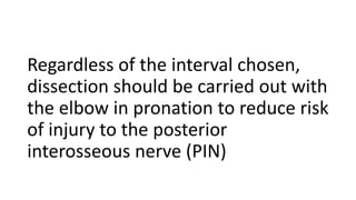 Regardless of the interval chosen,
dissection should be carried out with
the elbow in pronation to reduce risk
of injury to the posterior
interosseous nerve (PIN)
 