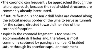 •The coronoid can frequently be approached through the
lateral approach, because the radial-sided structures are
commonly already interrupted.
•If suture fixation is chosen 2 drill holes are created along
the subcutaneous border of the ulna to serve as tunnels
for the suture, directed toward either side of the
coronoid footprint
•Typically the coronoid fragment is too small to
accommodate drill holes and, therefore, is most
commonly captured by passing a number-1 braided
suture through its anterior capsular attachment
 