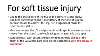 For soft tissue injury
• Due to the critical role of the LCL as the primary lateral elbow
stabilizer, soft tissue repair is mandatory at the time of surgery
because failure to address this injury is a significant cause for
recurrent instability.
• Most commonly, the LCL and posterolateral capsule are avulsed as a
sleeve from the lateral condyle, leaving a characteristic bare spot
• Surgical repair with suture anchors or bone tunnels placed at the
origin of the LCL at the bare area on the epicondyle with the elbow in
supination
 