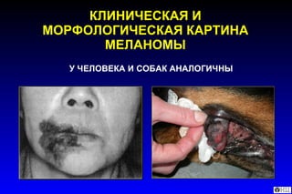 КЛИНИЧЕСКАЯ И МОРФОЛОГИЧЕСКАЯ КАРТИНА МЕЛАНОМЫ У ЧЕЛОВЕКА И СОБАК АНАЛОГИЧНЫ 