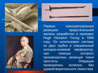Первую трансуретральную
резекцию предстательной
железы разработал и произвел
Hugh Hampton Young в 1909
году. Он использовал систему
из двух трубок и специальный
холодно-ножевой перфоратор,
при помощи которого
производилась резекция ткани
простаты. Операция
проводилась вслепую, без
удовлетворительного гемостаза.
 