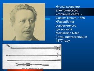 •Использование
электрического
источника света -
Gustav Trouve, 1869
•Разработка
современного
цистоскопа
Maximillian Nitze
( отец цистоскопии) в
1877 году
 