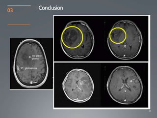03   Conclusion




                  25
 