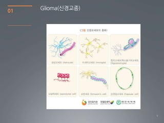 01   Glioma(싞경교종)




                    5
 