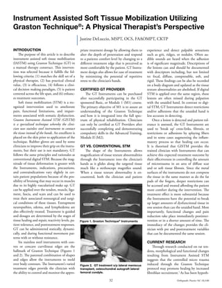 32 Orthopaedic Practice Vol. 18;3:06
Instrument Assisted Soft Tissue Mobilization Utilizing
Graston Technique®
: A Physical Therapist’s Perspective
Justine DeLuccio, MSPT, OCS, FAAOMPT, CKTP
INTRODUCTION
The purpose of this article is to describe
instrument assisted soft tissue mobilization
(IASTM) using Graston Technique (GT) in
a manual therapy construct. This interven-
tion was selected because it fulfills the fol-
lowing criteria: (1) matches the skill set of a
physical therapist, (2) has practical clinical
value, (3) is efficacious, (4) follows a clini-
cal decision making paradigm, (5) is patient
centered across the life span, and (6) enhanc-
es treatment outcomes.
Soft tissue mobilization (STM) is a rec-
ognized intervention used to ameliorate
pain, functional limitations, and impair-
ments associated with somatic dysfunction.
Graston Instrument Assisted STM (GISTM)
is a specialized technique whereby the clini-
cian uses stainless steel instruments to contact
the tissue instead of the hands. An emollient is
placed on the skin prior to application of the
technique. Rubber gloves are used by some
clinicians to improve their grip on the instru-
ments, but their use is not mandatory. GT
follows the same principles and rationales as
conventional digital STM. Because the mag-
nitude of tissue deformation is greater with
the Instruments, indications, precautions,
and contraindications vary slightly in cer-
tain patient populations because of the pos-
sibility of bruising that may occur in muscles
due to its highly vascularized make up. GT
can be applied over the tendon, muscle, liga-
ment, fascia, and scars and can be used to
treat their associated nonsurgical and surgi-
cal conditions of these tissues. Entrapment
neuropathies, edema, and lymphedema are
also effectively treated. Treatment is guided
and dosages are determined by the stages of
tissue healing and repair, reactivity levels, pa-
tient tolerance, and posttreatment responses.
GT can be administered statically, dynami-
cally, and during functional movement pat-
terns with or without resistance.
Six stainless steel instruments with con-
vex or concave curvilinear edges are the
hallmark of Graston Technique (Figures 1
and 2). The patented combination of shapes
and edges allow the instruments to mold
over body contours. The Instrument’s varied
treatment edges provide the clinician with
the ability to control and monitor the appro-
priate treatment dosage by allowing them to
alter the depth of penetration and respond
to a patients comfort level by changing to a
different treatment edge that is perceived as
more comfortable by the patient. GT Instru-
ment design also allows for ease of treatment
by minimizing the potential of repetitive
stress to the clinician’s hands.
CERTIFIED GT PROVIDER
The GT Instruments can be purchased
after successfully participating in the GT
sponsored Basic, or Module 1 (M1) course.
The primary objective of M1 is to assure an
understanding of the Graston Technique
and how it is integrated into the full spec-
trum of physical rehabilitation. Clinicians
can only be certified as GT Providers after
successfully completing and demonstrating
compulsory skills in the Advanced Training,
Module II (M2).
GT VS. CONVENTIONAL STM
The shape of the Instruments allows
magnification of tissue texture abnormalities
through the Instrument into the clinician’s
hands as it glides along the targeted tissue
much like a stethoscope magnifies sound.
When a tissue texture abnormality is en-
countered, both the clinician and patient
experience and detect palpable sensations
such as grit, ridges, or nodules. Often au-
dible sounds are heard when the adhesion
is of significant magnitude. Descriptions of
the lesions can and should be documented
with descriptors including, but not limited
to: focal, diffuse, compressible, soft, and
rigid. These findings can be also be recorded
on a body diagram and updated as the tissue
texture abnormalities are abolished. If digital
STM is applied over the same region, these
lesions are often missed during palpation
with the unaided hand. In contrast to digi-
tal STM, GT Instruments detect restrictions
and/or adhesions that the unaided hand is
less accurate in detecting.
Once a lesion is detected and patient tol-
erance is assessed, the GT Instruments are
used to ‘break up’ cross-links, fibrosis, or
restrictions or adhesions by splaying fibers
and in some cases augmenting the inflam-
matory process so that healing can occur.
It is theorized that GISTM provides the
trained clinician with Instruments that can
achieve this expected treatment outcome by
their effectiveness in controlling the amount
of microtrauma in an area of diffuse scar
and or soft tissue fibrosis. Since the metal
surfaces of the instruments do not compress
the tissue in the same manner as do the fat
pads of the fingers, deeper restrictions can
be accessed and treated affording the patient
more comfort during the intervention. The
treatment effect is more substantial because
the Instruments have the potential to break
up larger amounts of dysfunctional tissue in
one session than can the unaided hand. Most
importantly, functional changes and pain
reduction take place immediately postinter-
vention or in a shorter amount of time. The
immediacy of the changes provides the cli-
nician with pre and posttreatment variables
that can be documented the same session.
CURRENT RESEARCH
Through research conducted on rat ten-
dons, morphological and functional changes
resulting from Instrument Assisted STM
suggests that the controlled micro trauma
induced through the Graston Technique
protocol may promote healing by increased
fibroblast recruitment.1
As has been hypoth-
Figure 1. Graston Technique®
Instruments
Figure 2. GT treatment s/p lateral meniscus
transplant, osteochondral autograft lateral
femoral condyle.
 