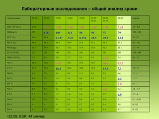 Лабораторные исследования – общий анализ крови 22.09. ESR: 44 мм/час 0 - 0,2 0.2 0.4 0.0 0.0 0.0 0.0 0.0 0.1 BA # 0 - 0,5 0.0 0.4 0.5 0.2 0.1 0.1 0.1 0.1 EO # 0,2 - 0,95 0.5 0.4 0.5 0.6 0.6 0.5 0.6 0.5 MO # 1,5 - 4 0.5 1.7 1.6 1.6 1.6 1.2 2.2 1.7 LY # 1,8 - 7,7 6.2 9.8 3.2 3.0 5.4 5.2 5.1 4.8 NE # 0 - 1 2.8 3.4 0.1 0.3 0.1 0.1 0.2 0.7 BA % 1 - 5 0.2 3.5 8.5 4.6 1.8 1.4 1.5 0.8 EO % 3 - 11 6.6 2.9 8.4 11.1 8.4 6.8 7.5 6.5 MO % 19 - 37 7.1 13.6 28.3 28.8 20.4 16.8 27.8 23.7 LY % 83.3 76.6 54.7 55.2 69.3 74.9 63.0 68.3 NE % 4,5 - 11 7.4 12.7 5.8 5.4 7.7 7.0 8.0 7.2 WBC (10^9L) 150 - 400 253 231 242 180 201 184 219  232 PLT (10^9/L) 27 - 34 32.1 32.1 32.6 31.8 32.5 32.3 31.9 32.0 MCH (pg) 81 - 103 97.3 96.7 97.1 97.4 96.9 96.8 98.2 98.6 MCV (fL) 37 - 51 23.8 29.3 28.5 0.276 33.9 0.327 36.4 39.6 HCT (%) 129 - 174 79 97 96 90 114 109 118 129 HGB (g/L) 3,8 - 5,8 2.45 3.03 2.94 2.83 3.50 3.38 3.71 4.02 RBC (10^12/L) Норма' 26.09 21.09. 23:53 21.09. 08:23 18.09.  16.09 15.09 13.09 12.09.  Анализ крови  