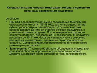 Спиральная компьютерная томография головы с усилением неионным контрастным веществом 26.09.2007  При СКТ определяется объёмное образование 45х37х32 мм однородной плотности  (45-48 HU), располагающееся интра- суб- и супраселлярно, занимающее 1\3 основной пазухи, которое доходит до нижних отделов боковых желудочков, с ровными чёткими контурами. После введения контрастного вещества плотность образования не повысилась. III желудочек расширен до 10-11 мм, боковые желудочки также умеренно расширены, симметричны, срединные структуры мозга не смещены. Субарахноидальное пространство головного мозга равномерно расширено. Заключение:  КТ-картина объёмного образования хиазмально-селлярной области, вероятнее всего- аденома гипофиза. Диффузные атрофические изменения ткани головного мозга. 