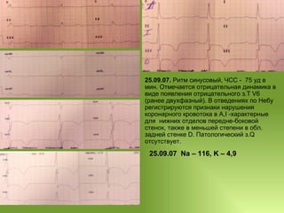 25.09.07.  Ритм синусовый, ЧСС -  75 уд в мин. Отмечается отрицательная динамика в виде появления отрицательного з.Т V6 (ранее двухфазный). В отведениях по Небу регистрируются признаки нарушения коронарного кровотока в А,I -характерные для  нижних отделов передне-боковой стенок, также в меньшей степени в обл. задней стенке D. Патологический з.Q отсутствует.  25 .09.07   Na – 116, K – 4,9 