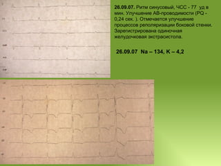 26.09.07.  Ритм синусовый, ЧСС - 77  уд в мин. Улучшение АВ-проводимости (РQ - 0,24 сек. ). Отмечается улучшение процессов реполяризации боковой стенки.  Зарегистрирована одиночная желудочковая экстрасистола. 26 .09.07   Na – 134, K – 4,2 