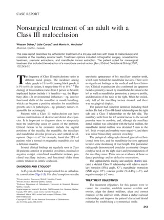 CASE REPORT

Nonsurgical treatment of an adult with a
Class III malocclusion
Wissam Daher,a Julie Caron,b and Morris H. Wechslerc
Montréal, Québec, Canada
This case report describes the orthodontic treatment of a 43-year-old man with Class III malocclusion and
crossbite of the maxillary anterior teeth. Treatment options included orthognathic surgery, nonextraction
treatment, premolar extractions, and mandibular incisor extraction. The patient opted for nonsurgical
treatment that included the extraction of a mandibular central incisor. (Am J Orthod Dentofacial Orthop 2007;
132:243-51)

T

he frequency of Class III malocclusions varies in
different racial groups. The incidence among
white people is 1% to 4%; among black people, it
is 5% to 8%; in Asians, it ranges from 4% to 14%.1-3 The
etiology of this condition varies from 1 person to the next;
implicated factors include (1) heredity— eg, the Hapsburg chin; (2) environmental inﬂuences— eg, anterior
functional shifts of the mandible or mouth breathing,
which can become a positive stimulus for mandibular
growth; and (3) pathologies— eg, pituitary tumors responsible for acromegaly.
Patients with a Class III malocclusion can have
various combinations of skeletal and dental discrepancies. It is important to diagnose these to adequately
treat the underlying cause or causes of the problem.
Critical factors to be evaluated include the sagittal
positions of the maxilla, the mandible, the maxillary
and mandibular alveolar processes, and vertical development. Guyer et al,4 for example, found that 57% of
patients with a normal or prognathic mandible also had
a deﬁcient maxilla.
Several clinical ﬁndings are regularly seen in Class
III patients: anterior or posterior crossbites, minimal or
negative overjet, retroclined mandibular incisors, proclined maxillary incisors, and functional slides from
centric relation to centric occlusion.

DIAGNOSIS AND ETIOLOGY

A 43-year-old black man presented for an orthodontic consultation (Figs 1-5). His chief complaint was the

unesthetic appearance of his maxillary anterior teeth,
which were behind the mandibular incisors. There were
no signiﬁcant ﬁndings in his medical and dental histories. Clinical examination also conﬁrmed the apparent
facial asymmetry caused by mandibular deviation to the
left as well as mandibular protrusion, a concave proﬁle,
and deviation of the nose to the right. When he smiled,
only half of the maxillary incisor showed, and there
was no gingival display.
The patient had complete dentition including third
molars. He had a Class III dental relationship on the right
side and a Class I relationship on the left side. The
maxillary teeth from the left central incisor to the second
premolar were in crossbite, and, although the maxillary
dental midline was coincident with the facial midline, the
mandibular dental midline was deviated 5 mm to the
left. Both overjet and overbite were negative, and there
was minor bimaxillary anterior crowding.
The periapical radiographs showed generalized horizontal bone loss, and the mandibular incisors appeared
to have some shortening of root length. The panoramic
radiograph demonstrated condylar asymmetry (longer
condylar neck on the right side) and pneumatization of
the maxillary sinus. There was no evidence of bone or
dental pathology and no defective restorations.
The cephalometric tracing and analysis (Table) indicated a skeletal Class III relationship with relative maxillary retrusion (SNA angle, 83°), mandibular protrusion
(SNB angle, 85°), concave proﬁle (N-A-Pogϭ–3°), and
negative overjet (–2 mm).

a

Private practice, Vancouver, British Columbia, Canada.
Private practice, Montréal Québec, Canada.
c
Professor, Department of Orthodontics, Université de Montréal, Montréal,
Québec, Canada.
Reprint request to: Morris H. Wechsler, 5445 Rosedale Ave, Montreal, Quebec,
Canada, H4V 2H7; e-mail, morris.wechsler@mcgill.ca.
Submitted, March 2005; revised and accepted, February 2006.
0889-5406/$32.00
Copyright © 2007 by the American Association of Orthodontists.
doi:10.1016/j.ajodo.2006.02.034
b

TREATMENT OBJECTIVES

The treatment objectives for this patient were to
correct the crossbite, establish normal overbite and
overjet, align the dental midlines, align and correct
rotations of the anterior teeth, obtain a stable occlusal
relationship, and improve the patient’s facial and dental
esthetics by establishing a symmetrical smile.
243

 