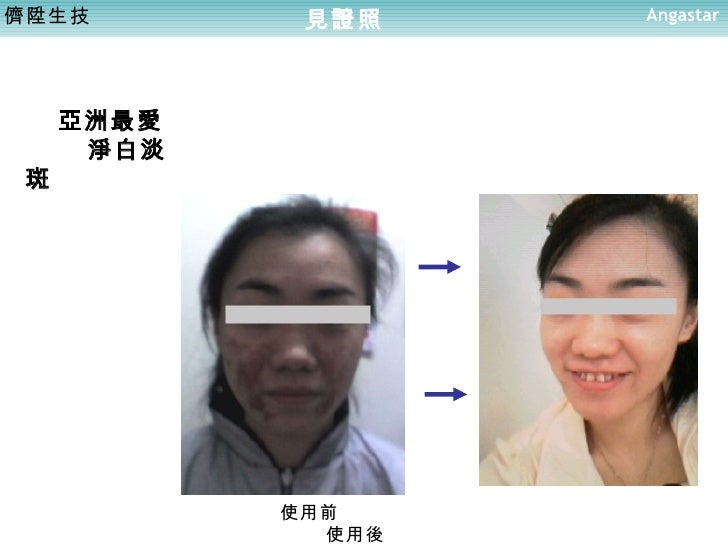 08 Angastar保養產品流程