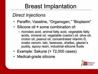 Breast Implantation Paraffin, Vaseline, “Organogen,” “Bioplaxm” Silicone oil  +  some combination of:  ricinoleic acid, animal fatty acid, vegetable fatty acids, mineral oil, vegetable (castor) oil, olive oil, croton oil, peanut oil, concentrated vitamin D, snake venom, talc, beeswax, shellac, glazier’s puddy, epoxy resin, industrial silicone fluids Example: Sakurai (> 72,000 cases)  Medical-grade silicone Direct Injections 
