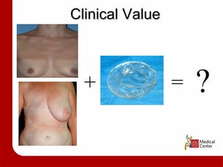 Clinical Value + = ? 