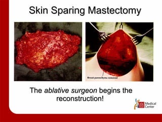 Skin Sparing Mastectomy The  ablative surgeon  begins the reconstruction!  