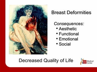 Breast Deformities Consequences: Aesthetic Functional Emotional Social Decreased Quality of Life 